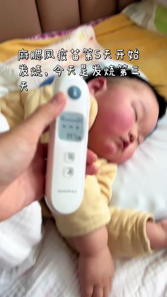 在家处理(核心:降温+补水)
1. 体温≥38.5℃,用对乙酰氨基酚(泰诺林) 或 布洛芬(美林) 退烧,按体重给药,间隔4–6小时,24小时不超过4次
2. 体温<38.5℃,少穿、少盖,室温24–26℃
多喂水/奶,少量多次,防脱水
3. 饮食:清淡、易消化,不想吃别强迫
4. 休息:多睡、少外出、不洗澡(避免着凉)
⚠️ 必须就医的情况(出现任一就去)
• 发热 ≥3天不退 或 超过39℃ 用药无效
• 精神差、嗜睡、烦躁、尖叫、眼神发直
• 抽搐、皮疹密集、呼吸困难、口唇发紫
• 拒奶拒水、尿量明显减少(6小时无尿)
• 呕吐频繁、腹泻带血
📌 小提醒
• 疫苗发热一般 1–3天 就好,不用抗生素
• 出疹子(热退疹出)是正常反应,不痒不痛,2–3天消退#麻腮风发烧 #麻腮风疫苗之王 #苗王名不虚传