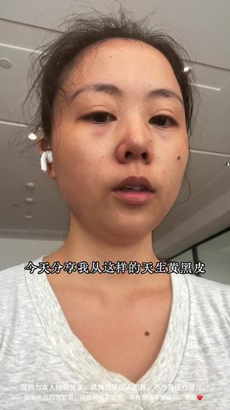 《黄黑皮逆袭》特🐮啊啊啊!真的可以白! #变美 #美白 #逆袭 #护肤