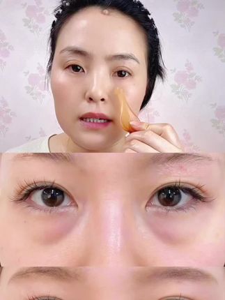 阿卡露十花养眼油眼部精华油眼霜淡化眼纹黑眼圈眼袋抗皱#眼部保养 #眼部护理 #眼部精华油
