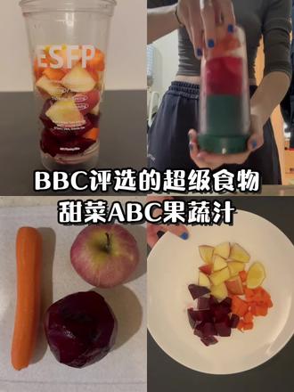 BBC推荐的超级食物.
今日分享一款被BBC评价的【超级食物|【甜菜做的ABC果蔬汁】
A是apple苹果
B指的beetroot甜菜
C则是carrot胡萝卜
我用的:苹果半个、甜菜3/1个、胡萝卜半根
甜菜根的营养价值
甜菜根(Beetroot)是一种营养丰富的蔬菜,主要健康益处包括:
1. 膳食纤维:促进消化健康,调节血糖。
2. 天然抗氧化剂(如甜菜红素):抗炎、保护细胞。
3. 维生素和矿物质:富含叶酸(B9)、钾、铁、维生素C。
4. 硝酸盐:可能降低血压、改善运动耐力。
5. 低热量高营养:适合健康饮食。
💡注意事项:
❌含草酸,榨汁也需要焯水再食用,
❌肾结石患者需适量;
❌血糖高的人群建议不食用
❌糖尿病患者需控制摄入.或不食用
【BBC是什么 ?顺便科普一波】
BBC(British Broadcasting Corporation,英国广播公司)是英国公立媒体机构,全球最具影响力的新闻媒体之一
BBC健康栏目(BBC Health)常发布营养学科普,若提及甜菜根,内容通常基于研究,但建议交叉验证信息来源(如学术论文或其他权威机构)#补血 #甜菜根 #果蔬汁 #健康养生 #营养与健康