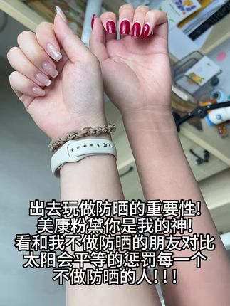太阳会平等惩罚每一个不涂防晒的人!
