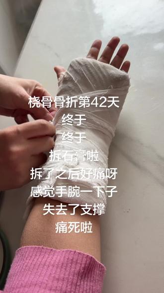 #桡骨骨折 这是条有味道的视频,第42天了,终于拆石膏了,拆完后,感觉手腕一下子没有支撑了,往下坠的感觉,好痛呀,尝试握拳,也是痛,康复之路看来很难呀#骨折恢复记录 #骨折康复