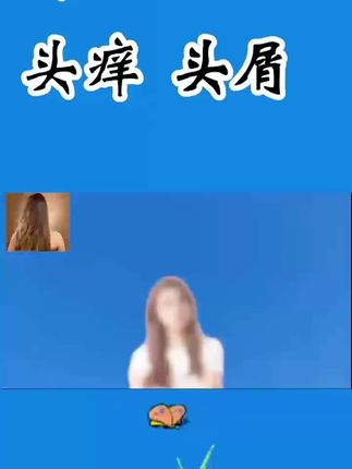#去屑洗发水推荐 #厂家直销全国各地发货🫰