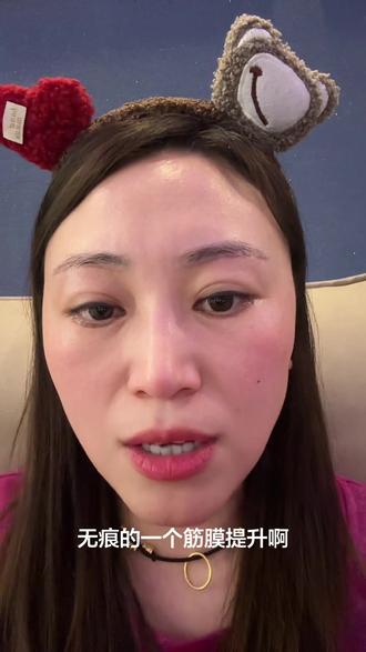 #筋膜提升悬吊术 提眉 姐妹们 原来不拆线是这个原因✌️😘😘😘原来我做的是无痕青春定点提眉!嘿嘿捡着😃😃😃