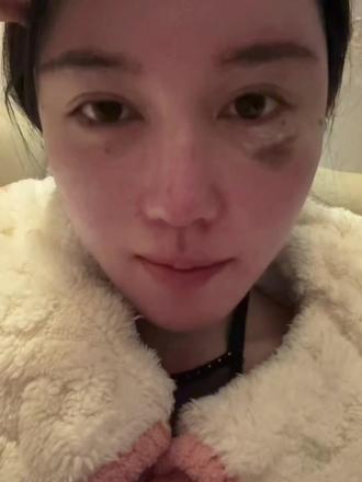 #高山根#低山根 的不同效果 (这里默认起点适中)