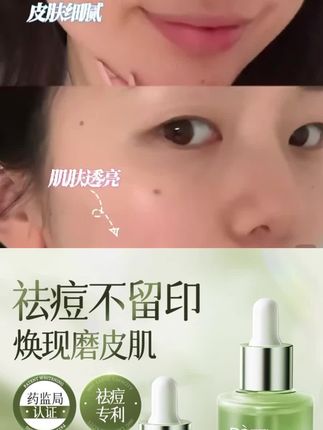 水杨酸精华液收缩毛孔粗大刷收敛酸修复去黑头闭口净粉刺祛痘印坑#好物分享 #护肤好物 #好产品一起分享 #强烈推荐 #学生党必备