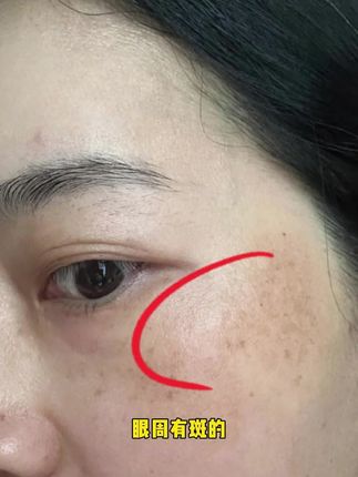 斑斑点点问题影响颜值,你就试一试这款#好物推荐🔥