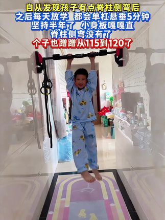 自从发现孩子脊椎侧弯,愁的整夜睡不着。听从白大褂的建议家里安装个单杠,每天让孩子在上面悬垂一会,舒展身体还可以增强手臂力量。孩子也变得更加自信阳光。#脊椎侧弯 #体态纠正 #育儿经验分享 #拉单杠