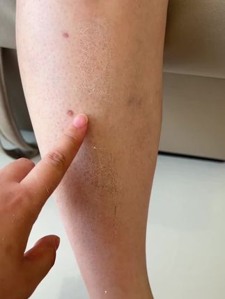 哪里有老茧死皮搓哪里!不要搓嫩肉的地方就行!尤其脚后跟嘎嘎好使!#磨脚神器#脚后跟粗糙怎么变嫩 #超便宜超划算