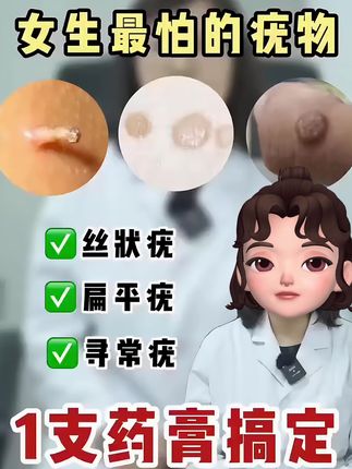 如果你也有疣体烦恼,试试这款去疣凝胶。专祛扁平疣、寻常疣#寻常疣#扁平疣 #丝状 #科普健康知识 #脖子上的小肉粒