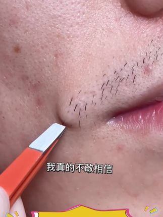 #拔胡子#眉夹镊子 #拔胡子神器 #眉夹镊子