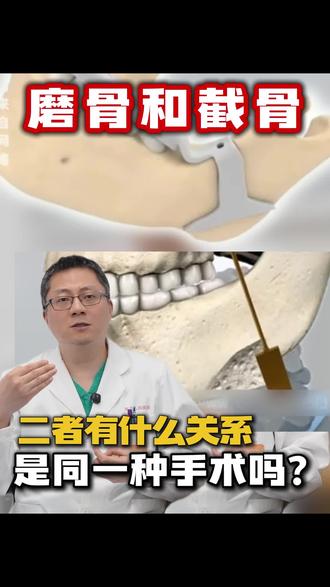 磨骨和截骨是什么关系,为什么有人叫磨骨有人叫截骨?#磨骨#截骨#下颌角#上海九院#医学科普