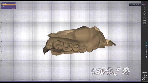 #Exocad 翻转三角网格