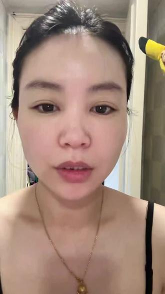 打卡 #凌博士次抛 第79天
#皱纹 #晚间护肤 #玻尿酸 #全分子玻尿酸