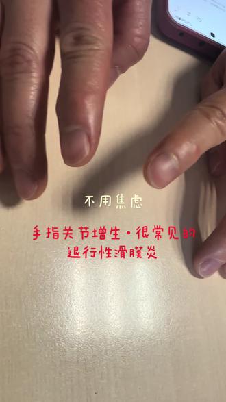 50岁以上女士很常见的关节增生、有时有疼痛! 手关节增生很明显,多数属于普通的退行性#滑膜炎,不是#类风湿性关节炎 在手部非常常见,绝大多数属于骨关节滑膜炎(退行性变)它是关节因长期使用、劳损老化,导致软骨磨损、骨质增生(骨刺)和局部滑膜炎症所致,是“用旧了”的磨损问题。这与类风湿关节炎——一种全身性的自身免疫性疾病,有本质区别。退行性变通常更局限、症状较轻,后者则是免疫系统攻击全身关节滑膜,引起更广泛的肿痛和破坏。虽然两者都可能引起手部不适,但病因和性质完全不同。#手指疼痛 #腱鞘炎 #武汉协和医院李涛 今天开启腊月第一天