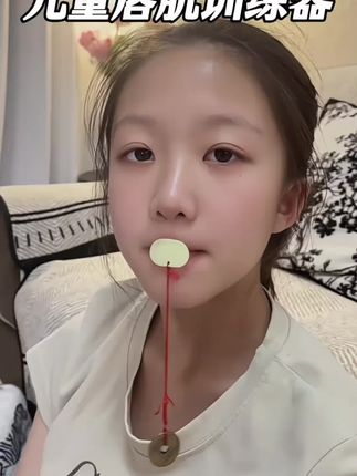 带上这个矫正器 下巴那里好明显就出来了 如果森碟早点矫正 也不至于17岁错过最佳矫正期 可惜时间不能重来 #口呼吸 #张嘴呼吸会变丑 #张嘴呼吸 #总是张嘴睡觉怎么办 #习惯性张嘴