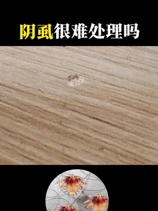 阴虱很难处理吗 【保密发货】,成人阴虱,儿童头虱,成分温和 #阴虱 #阴虱喷雾剂 #仁和复方百部酊喷剂 #虱子