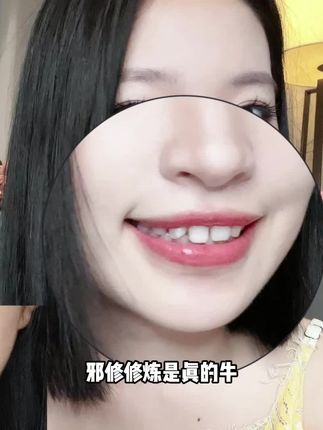 惊呆我啦 时间紧 任务重 有牙黄牙渍的家人快来看看呀 #牙齿美白 #口腔护理 #出游好物