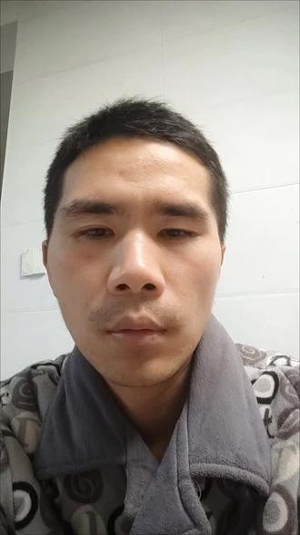 #近视
本内容为纯科普,仅供参考,不构成医疗建议。