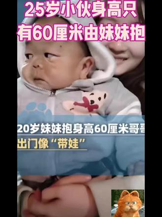 25岁小伙身高60厘米#疑难杂症#宝妈分享 #育儿小常识 #家庭育儿小知识