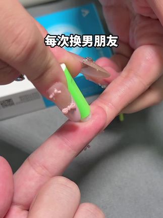 每次换男朋友我都要他先测艾滋感染四项安全后才可以在一起 #恋爱 #奔现 #情侣 #感染四项 #自测健康