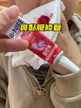 孩子反反复复流鼻x,千万别大意了#孩子经常流鼻血怎么办 #鼻黏膜修复