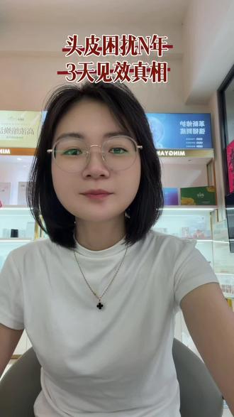 #头皮屑异常多?#洗发水各种换无效
喜欢分享好物,这个视频可能会帮助到你
录完视频看了一下记录:我是4月16日开始使用。
认真回顾,我头皮问题应该有三四年