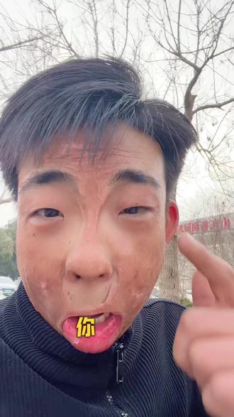 这个世界只奖励——摔得满身是血,却笑着爬起来继续跑的人。你,敢不敢做那个强者?💪#情感共鸣 #励志 #正能量 #林俊豪LJH #真实生活分享计划