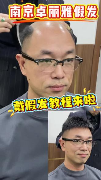 南京卓丽雅假发 详细戴发教程来咯#男士假发 #卓丽雅假发 #前后对比 #假发片佩戴教程 #假发