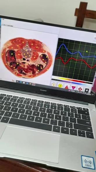 笔记本便携式 AI数字健康同频共振细胞修复仪#健康