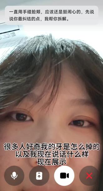 很多朋友好奇牙怎么掉的 附上缺门牙说话教程 #门牙 #倒霉熊