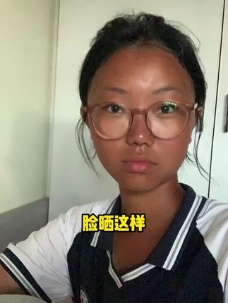脸色又暗又黄,还油腻没气色?赶紧用这款烟酰胺,改善脸部暗沉蜡黄,保持干净#烟酰胺凝胶#熊果苷乳膏#复方熊果苷乳膏
