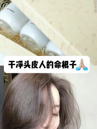 头皮痒,头屑多,头发出油?螨虫惹的祸!试试这款毛囊清洁洗发水,控油去屑!#去屑