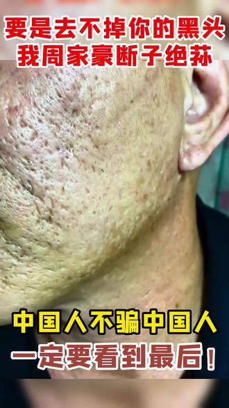 睡前怎样保养皮肤视频 b668d074589444759196b691e7ee7ee6~tplv-dy-resize-origshort-autoq-75:330.jpeg?x-expires=1990000800&x-signature=v37ph2NdCGOZMEh315Gs5Cxe5Ow%3D&from=3213915784&s=PackSourceEnum_AWEME_DETAIL&se=false&sc=cover&biz_tag=pcweb_cover&l=021674643817448fdbddc0200230424c842112f4000002bbbc3ed