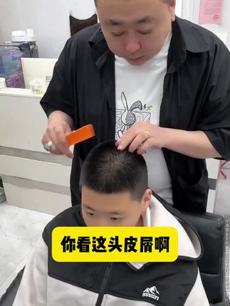 头皮痒,头屑多,头发出油?螨虫惹的祸!试试这款毛囊清洁洗发水,控油去屑!#去屑