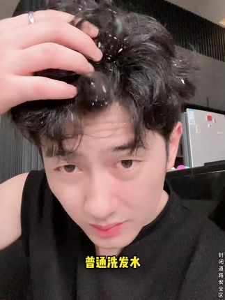 洗发水没选对,头屑反复,头痒?毛囊清洁洗发水,控油去屑止痒去油,清爽不油腻噢#去屑 #洗发水推荐