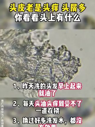 价格美丽,产品更良心!毛囊清洁洗发水,蓬松柔顺,控油去屑~#洗发水