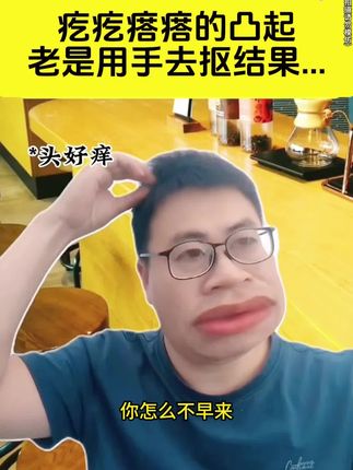 因为专业值得信赖。头皮痒,头屑多,头上长小圪塔,头发油腻的朋友,我力荐你用用这款毛囊清洁洗发水