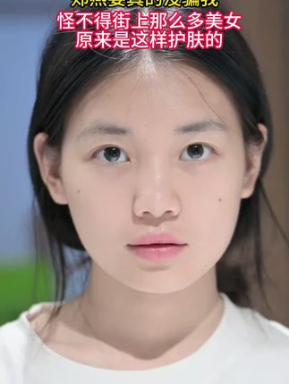 选对祛痘产品真的很重要,大糙脸必备的祛痘精华,有它在!脸上的#痘痘就翻不了天!决定你颜值的不是五官而是好皮肤!