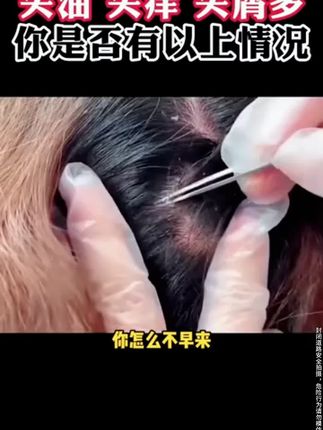 价格美丽,产品更良心!毛囊清洁洗发水,蓬松柔顺,控油去屑~#洗发水