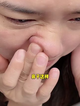【徐艺洋同款】但凡你早点知道这个#国货,也不至于被黑头闭口痘痘困扰这么多年!#焕肤水#毛孔粗大#徐艺洋#郑燕姿
