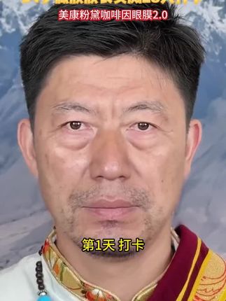 要想不显老,那么眼睛就得保养好,只要你#松松垮垮 看起来显老的你就赶紧去试试#眼膜 每天贴一贴改善眼周