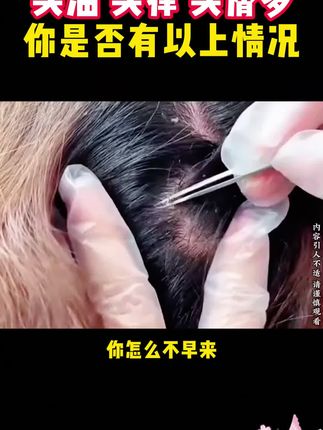 一般颜值不高的产品都有你意想不到的强大功效。比如这款毛囊清洁洗发水#控油去屑#二硫化硒洗发水#去屑止痒