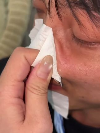 泰国white芦荟胶去黑头鼻贴:/祛黑头粉刺闭口导出液收缩毛孔男女#去黑头鼻贴# 去黑头粉刺#收缩毛孔提亮肤色#收缩毛孔粗