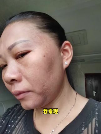 如果你脸上皮肤暗沉,不会化妆,又黑又黄得不到改善的,那你一定要试试这款 #美白洗面奶,欧丽源#美白效果!