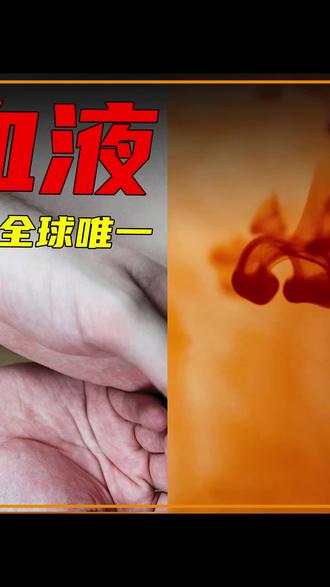 最危险的血型,你见过黄金血吗?血型可以改变吗? #血液 #黄金血 #稀有血型 #罕见 #科普一下 #张知识