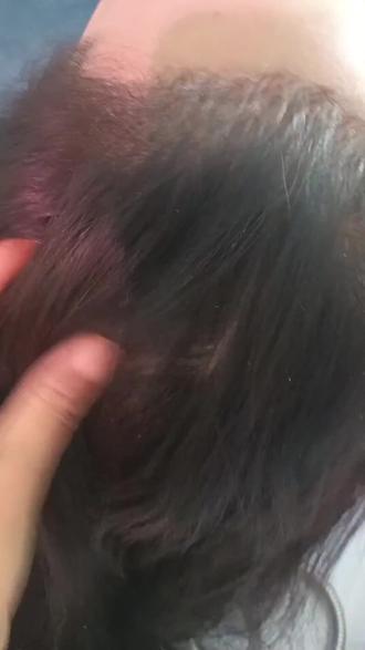 潍坊朋友看过来!艾丽莎美学工作室放大招,全息头疗配肩颈放松。百草养生汤蒸头,疏通经络。原价五百多套餐现198元,85分钟从头酥到脚,肩颈超放松,速冲! #躺着怎么洗头 #告别白发 #洗头发 #禅疗 #发现好地