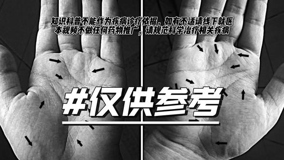 手纹105 三招教你快速看体质
【重要提醒】 本文仅供学习和参考,不可替代医疗,如有不适尽快就医!
#手纹#掌纹#智慧线#手纹线分析