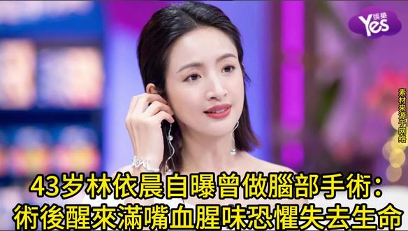 林依晨自曝曾做腦部手術:術後醒來滿嘴血腥味恐懼失去生命