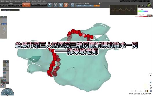 又是房颤独立的一天